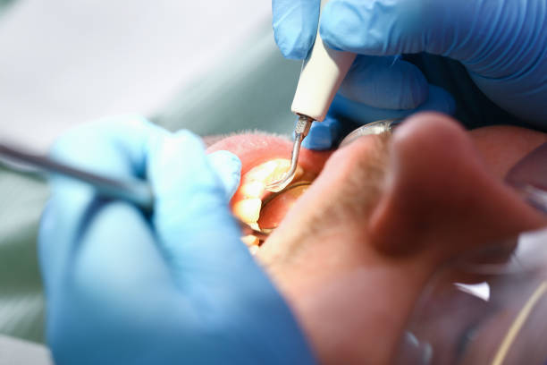 Best Emergency Dental Care for Trauma or Injury in Woodbranch, TX