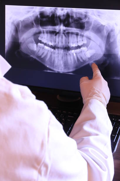 Best Emergency Tooth Extraction in Woodbranch, TX
