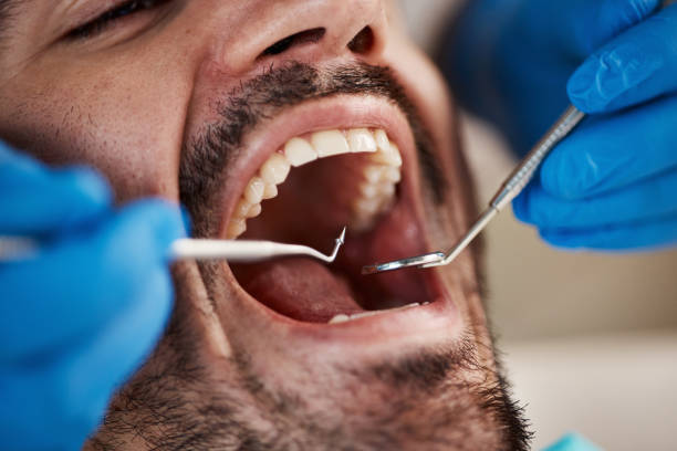 Best Pediatric Emergency Dentist in Woodbranch, TX