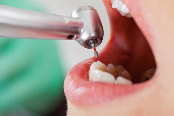 Best Same-Day Emergency Dentist in Woodbranch, TX
